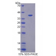 SDS-PAGE analysis of Macrophage Inflammatory Protein 3 beta Protein.