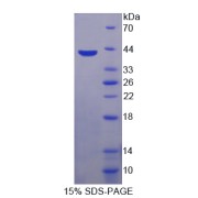 SDS-PAGE analysis of MIP1b Protein.