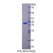 SDS-PAGE analysis of Cysteine And Glycine Rich Protein 1 Protein.