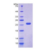 SDS-PAGE analysis of Cold Inducible RNA Binding Protein.