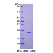 SDS-PAGE analysis of CAP2 Protein.