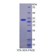 SDS-PAGE analysis of recombinant Mouse Breast Cancer Susceptibility Protein 2 Protein.