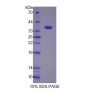 SDS-PAGE analysis of F-Box And Leucine Rich Repeat Protein 3 Protein.
