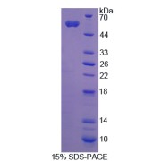 SDS-PAGE analysis of ADNP Protein.