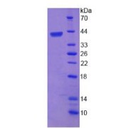 SDS-PAGE analysis of recombinant Human Baculoviral IAP Repeat Containing Protein 6 Protein.