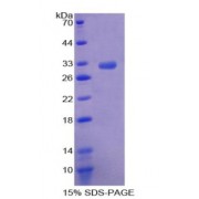SDS-PAGE analysis of Rho Associated Coiled Coil Containing Protein Kinase 2 Protein.