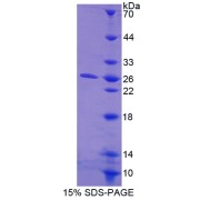 SDS-PAGE analysis of CTHRC1 Protein.