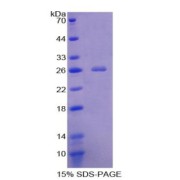 SDS-PAGE analysis of Vwa3a Protein.