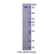 SDS-PAGE analysis of Platelet Derived Growth Factor Receptor Like Protein.