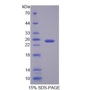 SDS-PAGE analysis of Lectin Galactoside Binding, Soluble 3 Binding Protein.