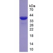 SDS-PAGE analysis of LTBP2 Protein.