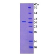 SDS-PAGE analysis of IFIH1 Protein.