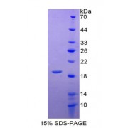 SDS-PAGE analysis of Leptin Protein.