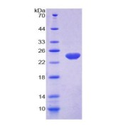 SDS-PAGE analysis of NOS3 Protein.