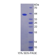 SDS-PAGE analysis of Resistin Protein.