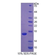 SDS-PAGE analysis of IL2 Protein.