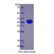 SDS-PAGE analysis of Xanthine Dehydrogenase Protein.