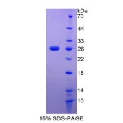 SDS-PAGE analysis of TIMP2 Protein.