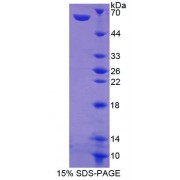 SDS-PAGE analysis of Amphiregulin Protein.