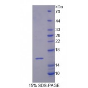 SDS-PAGE analysis of IL16 Protein.