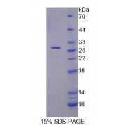 SDS-PAGE analysis of recombinant Dog Selectin, Endothelium Protein.