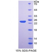 SDS-PAGE analysis of NOS3 Protein.