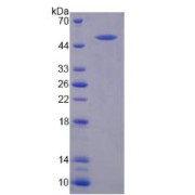 SDS-PAGE analysis of vWF Protein.