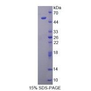 SDS-PAGE analysis of Adiponectin Protein.