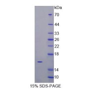 SDS-PAGE analysis ofrecombinant Dog Vascular Endothelial Growth Factor C Protein.