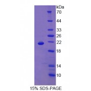 SDS-PAGE analysis of Myoglobin Protein.