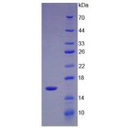 SDS-PAGE analysis of UDP Glucose Ceramide Glucosyltransferase Protein.