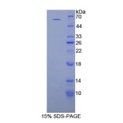 SDS-PAGE analysis of Proliferating Cell Nuclear Antigen Protein.