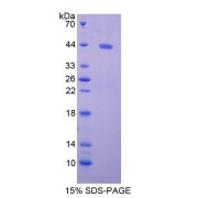 SDS-PAGE analysis of BDNF Protein.