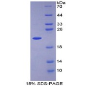 SDS-PAGE analysis of IL1RA Protein.