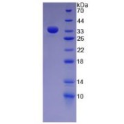 SDS-PAGE analysis of Fibronectin Protein.