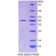 SDS-PAGE analysis of TIMP3 Protein.