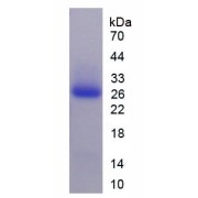 SDS-PAGE analysis of recombinant Human Agrin Protein.