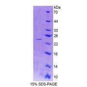 SDS-PAGE analysis of Syndecan 4 Protein.