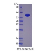 SDS-PAGE analysis of Transferrin Receptor 2 Protein.