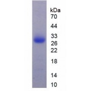 SDS-PAGE analysis of Complement Component 1, Q Subcomponent A Protein.