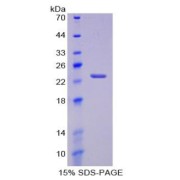 SDS-PAGE analysis of recombinant Human PTGS2 Protein.