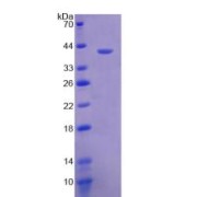 SDS-PAGE analysis of NPY Protein.