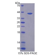 SDS-PAGE analysis of recombinant Human Prokineticin 2 Protein.