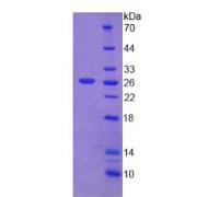 SDS-PAGE analysis of Desmoplakin Protein.