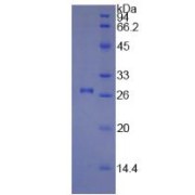 SDS-PAGE analysis of recombinant Human COL1A1 Protein.