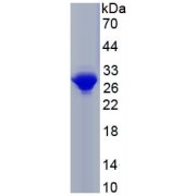 SDS-PAGE analysis of recombinant Human COL1A1 Protein.