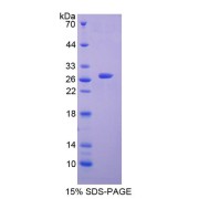 SDS-PAGE analysis of Choline Acetyltransferase Protein.