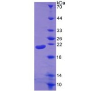 SDS-PAGE analysis of IL1B Protein.