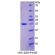 SDS-PAGE analysis of recombinant Human Collagen Type VI Alpha 3 (COL6A3) Protein.