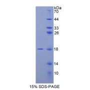 SDS-PAGE analysis of recombinant Human Angiogenin Protein.